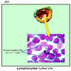 ����� �������� Lymphocytes